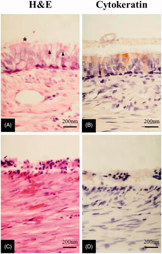 Figure 11. Higher magnification of H&E staining and immunohistochemical staining against cytokerain. A,B. PCL-OC group (8 weeks after transplantation). C,D. PCL group (6 weeks after transplantation). ×1000. The asterisk indicates cilia. The arrow head indicates goblet cell.