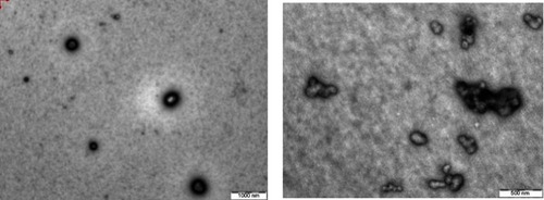 Figure 5 TEM of (A) InF12 before lyophilization and (B) Reconstituted lyophilized InF12-Tre2 after lyophilization.