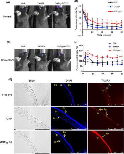 Figure 5 Ocular retention and distribution of GNP-gp91. (A) Photo to show fluorescence accumulated on normal mice eye treated by GNPTAMRA, free dye (TAMRA), and GNP-gp91TAMRA after 10 minutes dosing, and (B) its intensity variation curve changed with time. (C) Photo of neovascularized mice eye treated by variant fluorescent formulation after 10 minutes dosing, and (D) its intensity variation curve changed with time. Data are presented as mean ± SD (n = 3). (E) Corneal cryosections revealing the distribution of free dye, GNPTAMRA, and GNP-gp91TAMRA in cornea (yellow arrow in TAMRA images indicated dye or NPs location). Scale bar: 250 µm. Corneal epithelium: Ep, Stroma: St, endothelium: Ed.