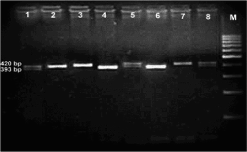 Figure 1 Genotyping of eNOS intron 4 polymorphism. Lanes 2, 3, and 7 show 420-bp bands, denoting the wild type (b) allele. Lanes 4 and 6 show 393-bp bands denoting homomutant (a) allele. Lanes 1, 5, and 8 show two bands at 427 and 393 bp denoting heteromutant type (ba). M is a marker ladder.