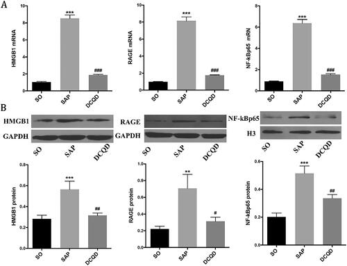 Figure 5. Impact of DCQD on the expression of HMGB1, RAGE and NF-κB p65 at the mRNA and protein levels in lung tissues. (A) RT-PCR analysis of HMGB1, RAGE and NF-κB p65 mRNA expression in lung tissues. (B) Western blot results of HMGB1, RAGE and NF-κB p65 protein expression in lung tissues. (C) Statistical results of B scanning densitometry. **p < 0.01, ***p < 0.001, compared with the SO group; #p < 0.05, ##p < 0.01, ###p < 0.001, compared with the SAP group. n = 10–14.