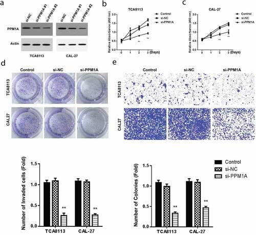 Figure 4. Knockdown of PPM1A suppresses OSCC growth, and invasion