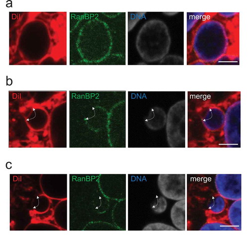 Figure 2. After MN were induced pharmacologically in HeLa cells, the nuclear boundary was visualized by the DiI and antibody costaining method. Representative images of micronucleus with seemingly intact nuclear boundary, which showed continuous DiI and RanBP2 signals (a and see also S4a), micronucleus with the nuclear boundary region exhibiting continuous DiI signals, but deficient for RanBP2 signals (b and see also S4b), and micronucleus with the nuclear boundary region deficient for both DiI and RanBP2 signals (c and see also S4 c) are shown. In a, b and c, DiI, anti-RanBP2 antibody and DNA staining patterns are represented at the left, middle-left and middle-right, respectively. A merged image is shown at the right. White arrows in b indicate the area exhibiting continuous DiI signals, but discontinuous RanBP2 signals, around the micronucleus. White arrows in c indicate the area deficient for both DiI and RanBP2 signals around the micronucleus. All fluorescence images were taken by an FV1200 laser scanning confocal microscope imaging system. Bar: 2.5 μm.