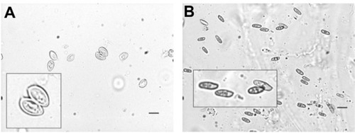 Figure 4 Microscopic spore shapes seen following in vitro acid digestion and zinc sulfate flotation.