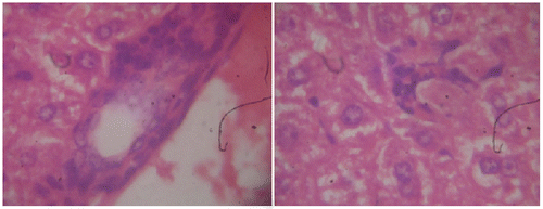 Figure 4. Section of mouse liver with silymarin treated group (100 mg/kg) showing a mild active hepatitis with small portal inflammation, slight lymphocytic infiltration, and no inflammatory of central vein. (Hematoxylin and eosin-stained paraffin section; H&E 400).