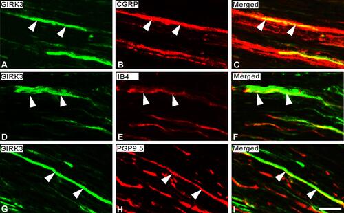 Figure 3 Expression of GIRK3-LI in sciatic nerve. (A–C) Double-staining shows a few GIRK3+ fibers (A) are CGRP+ (B) in sciatic nerve. (D–F) Some GIRK3+ fibers (D) are IB4+ (E). (G–I) GIRK3-LI (G) in sciatic nerve shows co-localization with an axonal marker PGP9.5 (H). Arrowheads indicate the co-localization of GIRK3-LI with each marker in sciatic nerve. (C), (F), and (I) are merged images. Scale bar indicates 20 μm (A–I).