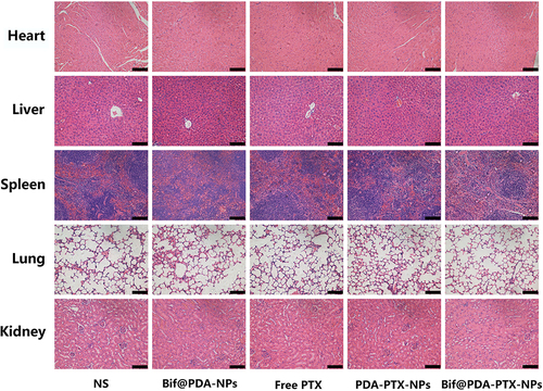 Figure 8 The H&E staining images of major organs (including heart, liver, spleen, lung and kidney) in each group after treatment. Scale bar=100 μm.