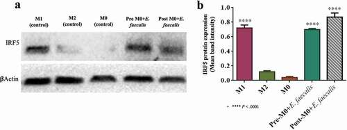 Figure 6. Expression of IRF5 protein in infected and control M1 macrophages. A. Western blot of IRF5, which is normally expressed in M1 macrophages, were expressed in pre-M0 + E. faecalis and post-M0 + E. faecalis, β-actin was used as the housekeeping protein. B. Bar chart showing the mean band intensity of IRF5 protein expression among the different tested groups (N = 3)