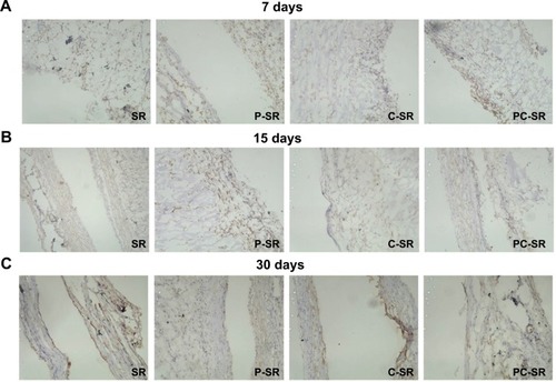 Figure 6 Positive expression degree of vimentin as analyzed by immunohistochemistry after implantation of silicone rubber materials. (×200)Notes: (A) 7 days. (B) 15 days. (C) 30 days.Abbreviations: SR, silicone rubber; P-SR, patterned silicone rubber; C-SR, C-ion-implanted silicone rubber; PC-SR, patterned C-ion-implanted silicone rubber.