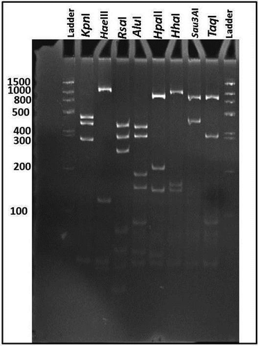 Fig. 2 Polyacrylamide gel showing RFLP profiles of 16S rDNA amplified by nested PCR using P1/P7 followed by R16F2n/R16R2 primer pairs from KVvY (GenBank accession number MH638316). PCR products were digested by AluI, HhaI, HpaII, RsaI, TaqI, KpnI, HaeIII, Sau3AI restriction enzymes. M, 100 bp DNA ladder.