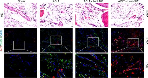 Figure 3 HE and immunofluorescence staining of the synovium in PTOA model mice. Synovial samples were stained for HE and immunofluorescence of Nrf2 (red) and CHI3L1 (green), with DAPI (blue) being used for nuclear counterstaining. The magnification is 200× or 400×.