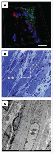 Figure 1. Mouse gastrocnemius muscle, 5 d post injury. (A). Laser scanning microscopy. Double immunofluorescent labeling shows F4/80 positive macrophages (red) preferentially distributed around growing myotubes (CD56, green). Nuclei were stained with DAPI (blue). Scale bar 20 μm. (B). Light microscopy on toluidine blue-stained semi-thin section of Epon-embedded samples, shows myotubes (MTB) surrounded by inflammatory infiltrate. Square marked area was further examined by transmission electron microscopy (in C). (C). TEM on square marked area in B shows a macrophage (M) which establishes close contacts with a myotube (MTB). The cell membranes of the macrophage and the myotube are closely apposed (15 nm), this apposition extending over 7 µm.