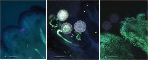 Figure 2. Cassava (Manihot esculenta Cranz) stigmas stained with aniline blue and analyzed with UV, wideband filter. a. Stigma in freshly exposed flower. Stigma’s edges are dark blue. Vascular bundles visible on the right lower corner show pale fluorescence. b. Germinating pollen on the stigma. One pollen tube shallow ingrowth to the stigma is visible in the center. Stigmatic tissue gives bright callose reaction in the vicinity of pollen grains. c. Stigma fixed three days after pollination. Fluorescence of two grains and their tubes has faded. Stigma surface gives strong yellow fluorescence typical for a fading process (scale bar = 100 μm).