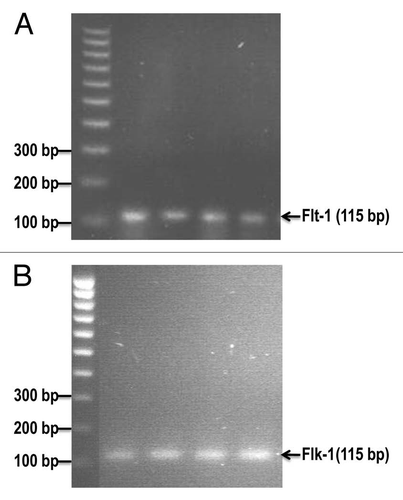 Figure 3 The mRNA expression of mouse VEGF receptor-1 (Flt-1) and VEGF receptor-2 (Flk-1) in cultured E0771 cells by reverse transcriptase-PCR analysis. (A) shows Flt-1 bands (115 bp). (B) shows Flk-1 bands (115 bp).