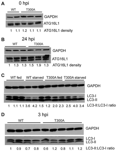 Figure 7. The ATG16L1T300A variant does not affect canonical autophagy response to UPEC infection. (a-b) Western blot detection of ATG16L1 and GAPDH (loading control) in whole bladder protein before infection (a) and 24 hpi (b). (c) Western blot detection of LC3 in whole bladder protein from fed and starved WT and T300A mice. (d) Western blot detection of LC3 in whole bladder protein from WT and T300A mice at 3 hpi. Numbers below the blots indicate densitometric quantification of the blots.