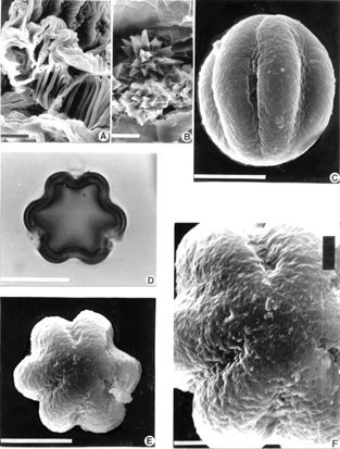 Figure 4 Flower (A, B, C, E, F) SEM photomicrography, (A) thickening of endothecium, (B) druses between the pollen sacs, (C) equatorial view of pollen, (E) polar view, (F) detail of the sculpture, (D) LM photomicrography of pollen in polar view. Bar size: 10 µm (A–F).