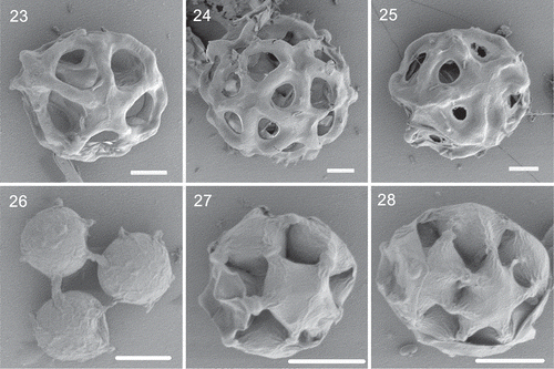 Figs 23–28. The SEM images of Hariotina laxa and Hariotina hainanensis. Figs 23–25. The SEM images of Hariotina laxa. Figs 23–24. Coenobia of Hariotina laxa (the mucilage layer removed by CTAB). Fig. 23. Hariotina laxa without removing the mucilage layer. Figs 25–28. SEM images of Hariotina hainanensis. Scale bar = 10 μm