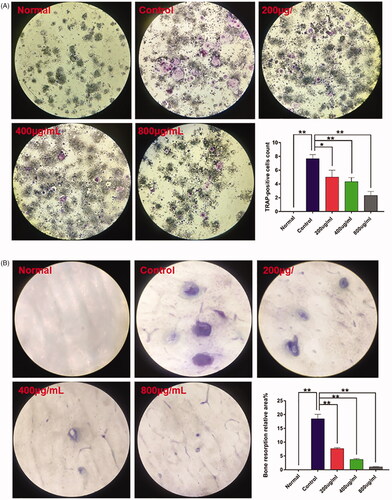 Figure 9. Effects of GSZD on TRAP staining (A) and bone resorption assay (B). Data are presented as the mean ± SD (n = 3), *p < 0.05, **p < 0.01 vs. control.