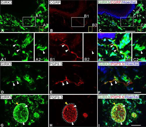 Figure 2 Characteristics of GIRK3 expression in skin of hind paw. (A–C) A large amount of GIRK3-LI (A) is seen in upper dermis, some co-localize with CGRP+ fibers (B). (A1, B1, C1) High magnification of immunofluorescence micrographs shows the co-localized fibers of GIRK3-LI (A1; arrowheads) and CGRP-LI (B1; arrowheads). (A2, B2, C2) Some GIRK3+ (A2; arrowheads), but CGRP− (B2; arrowheads) fibers are seen in the upper dermis. (D–F) GIRK3+ fibers (D; arrowheads) are also PGP9.5+ (E; arrowheads) in upper dermis. (G–I) GIRK3-LI (G) co-localizes with PGP9.5-LI (H) largely in nerve bundles (white arrowheads) and epineurium (yellow arrowheads) in lower dermis (I). Scale bars indicate 100 μm (A–C, G–I) and 20 μm (A1–C2, D–F).