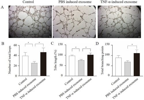 Figure 3. Exosome derived from FLS stimulated by TNF-α promoted angiogenesis of HUVECs. The angiogenesis assays were detected by tube formation assay after different treatment (a); the columns presented the number of total loops (B), tube length (C), and total branching points (D). *p < 0.05.