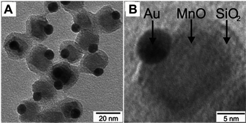 Figure 14 (A) Overview TEM bright field image of Au@MnO@SiO2 NPs, (B) TEM micrograph of a single Au@MnO@SiO2 particle. Reprinted with permission from Schick I, Lorenz S, Gehrig D, et al. Multifunctional two-photon active silica-coated Au@ MnO Janus particles for selective dual functionalization and imaging. J Am Chem Soc. 2014;136(6):2473–2483.Citation71 Copyright 2014 American Chemical Society.