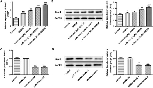 Figure 2. Effect of sufentanil treatment on the expression of Sesn2 in OGD/R-induced H9c2 cells. (A,B) Expression of Sesn2 determined by RT-qPCR (A) and Western blotting (B) after treatment with different doses of sufentanil. *p < 0.05, ***p < 0.001 vs. control; ##p < 0.01, ###p < 0.001 vs. OGD/R. (C,D) Expression of Sesn2 mRNA and protein determined by RT-qPCR (C) and Western blotting (D) after transfection with shRNA-Sesn2-1 or shRNA-Sesn2-2. ***p < 0.001 vs. shRNA-NC.Note: Sesn2, Sestrin 2; OGD/R, oxygen-glucose deprivation and reoxygenation.