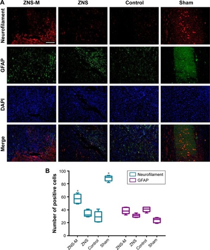 Figure 9 Histological analysis in SCI rats at 4 weeks.Notes: (A) Representative immunohistologic images of neurofilament (red), GFAP (green) and DAPI (blue) in different groups. (B) Quantitative analyses of neurofilament- and GFAP-positive cells under high-power visual fields. Quantitative data are represented as mean ± SD. *P<0.05 was considered significant. Scale bar =100 μm.Abbreviations: SCI, spinal cord injury; GFAP, glial fibrillary acidic protein; SD, standard deviation; ZNS, zonisamide; ZNS-M, zonisamide micelles.