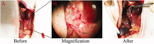 Figure 2. Urethral patency at 12 weeks after anastomosis with stent placement. The patency is demonstrated by the free passage of injected methylene blue solution. (A) Upper ureter before injection of methylene blue. (B) An enlarged view of the area marked out in panel A. The arrow indicates the ureter. (C) Upper ureter after the injection of methylene blue solution.