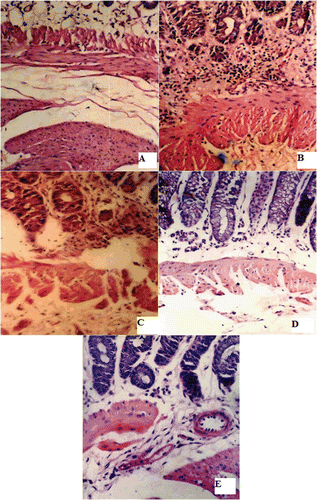 Figure 10.  Histological appearance of colonic tissues (A) normal group, (B) TNBS induced colitis group, (C) Spray coated capsules treated group, (D) F17 pulsatile capsules treated group and (E) commercial capsules treated group.