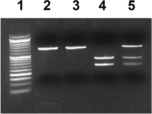 Figure 1 Representative photograph of PCR-RFLP analysis of p53 gene codon 72 polymorphisms. PCR-amplified genomic DNA corresponding to the p53 gene was digested with BstUI, which distinguishes among p53 genotypes. Lane 1 shows the DNA ladder marker, lane 2 shows the PCR product without restriction digestion, lane 3 shows the p53 codon 72 CC genotype, lane 4 shows the GG genotype, and lane 5 shows the CG genotype.