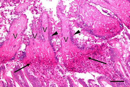 Figure 7. Small intestine of a chicken with naturally acquired necrotic enteritis produced by C. perfringens type G. Notice the necrotic and denudated villi (v), lined by large number of bacilli (arrow heads). A wide band of heterophils (arrows) separates the superficial necrotic villi from the more normal looking deep part of the tissue (bottom of the photograph). Scale bar = 100 μm. Hematoxylin and eosin