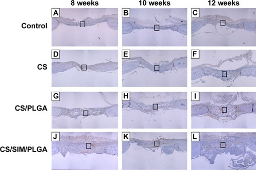 Figure 7 Immunohistochemistry analysis of bone morphogenetic protein-2 expression in calvarial defects 8, 10, and 12 weeks after implantation of bone graft substitutes.Notes: Calvarial defects implanted without bone graft substitutes were used as controls. (A–L) Higher magnification of the rectangle inset areas are shown as Figure 8.Abbreviations: CS, calcium sulfate; SIM, simvastatin; PLGA, poly(lactic-co-glycolic acid) microspheres.