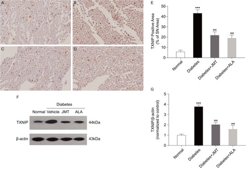 Figure 4 JMT suppressed TXNIP expression in SNs of diabetic rats.