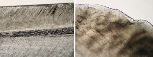 Figure 1. Light microscopic view of a ground section of normal and hypomineralized enamel. Normal mineralized enamel gave a translucent appearance. (×10 magnification) Hypomineralized enamel appeared more opaque than normal in incident light (the colour was white to beige). (×40 magnification).