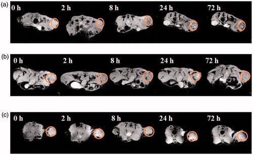 Figure 1. In vivo T2-MR images C6 tumor-bearing mice at designated time points after administration with (a) FA-targeted nanospheres, (b) non-FA-targeted nanospheres, and (c) FA-inhibited nanospheres. The tumor sites were highlighted with red circles.
