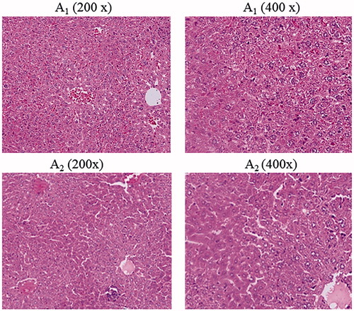 Figure 8. The histological section picture of the mice liver with slightly degeneration in tissue. This is likely to be related to the high concentration of the ZnO nanofluid and the sensitivity of the mice relative to it.