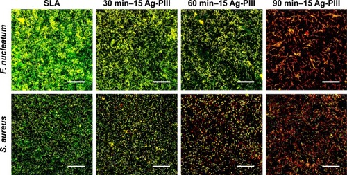 Figure 5 Fluorescent images of F. nucleatum and S. aureus cultured on SLA, 30 min–15 Ag-PIII, 60 min–15 Ag-PIII, and 90 min–15 Ag-PIII for 24 h, obtained by CLSM after staining with SYTO 9 and propidium iodide.Notes: The scale bar represents 75 μm. 30 min–15 Ag-PIII, titanium surfaces treated by first SLA procedure and then silver plasma immersion ion implantation at 15 kV for 30 minutes; 60 min–15 Ag-PIII, titanium surfaces treated by first SLA procedure and then silver plasma immersion ion implantation at 15 kV for 60 minutes; 90 min–15 Ag-PIII, titanium surfaces treated by first SLA procedure and then silver plasma immersion ion implantation at 15 kV for 90 minutes.Abbreviations: SLA, sand-blasted, large grit, and acid etched; Ag-PIII, silver plasma immersion ion implantation; h, hours; CLSM, confocal laser scanning microscopy; min, minutes.