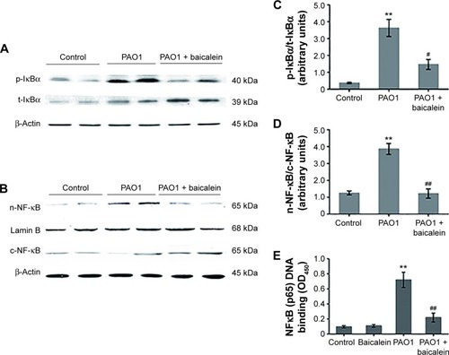 Figure 13 Effects of baicalein on the expression of NFκB-related proteins in macrophages infected by Pseudomonas aeruginosa PAO1.