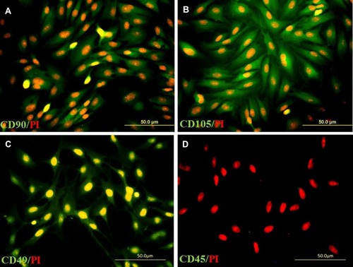Figure 1 Immunolabeling of adipose-derived stem cells (ADSC) with primary antibodies to CD90 (A), CD105 (B), CD49d (C), and CD45 (D), respectively; incubated with a secondary antibody conjugated with FITC (green) and nucleus counterstained with propidium iodide (red).
