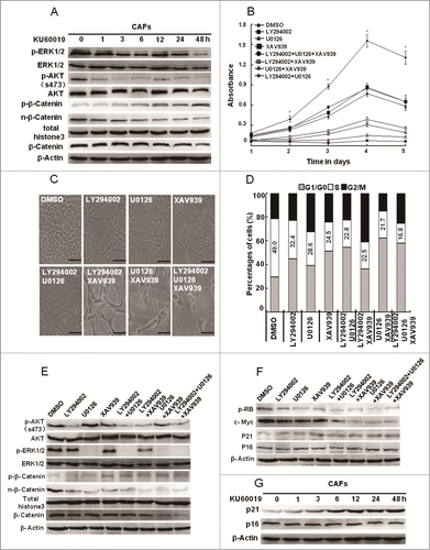 Figure 7 (See previous page). Oxidized ATM enhances the CAFs proliferation through activating key proliferation-related signaling pathways. (A) CAFs were treated with KU60019 (5 μM) for the indicated time points. Immunoblotting analyses were performed with the indicated antibodies. Total histone 3 functions as a loading control for nuclear proteins. (B) CAFs were treated separately or jointly with LY294002 (20 μM), U0126 (25 μM), and XAV939 (10 μM) for the designed time. Their growth curves were determined by MTT assay (*, P < 0.05, untreated CAFs vs treated CAFs with indicated inhibitor(s)). (C) Photomicrographs of CAFs treated with or without inhibitor(s) as in B indicated for 2 d. Scale bars, 50 μm. (D) Flow cytometry analyses of CAFs treated with indicated inhibitor(s) for 24 h as in B. (E) CAFs were treated separately or jointly with LY294002 (20 μM), U0126 (25 μM), and XAV939 (10 μM) for 24 h. Immunoblotting analysis was done with the indicated antibodies. Total histone 3 functions as a loading control for nuclear proteins. (F) CAFs were treated separately or jointly with LY294002 (20 μM), U0126 (25 μM), and XAV939 (10 μM) for 24 h. The levels of p-RB, c-Myc, p21Cip1, and p16Ink4a were analyzed by western blot. (G) CAFs were treated with KU60019 (5 μM) for the indicated time. Immunoblotting analysis was performed with the indicated antibodies.