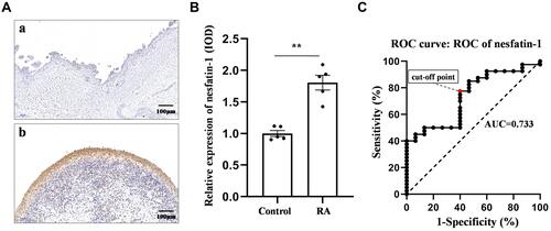 Figure 1 Nesfatin-1 levels in the synovium of the RA and control groups. (A) Typical immunohistochemistry images of nesfatin-1 protein expression (n = 5); (B) Quantitative analysis of nesfatin-1 protein expression based on immunohistochemistry results; (C) ROC curve of synovium nesfatin-1 in the identification of patients with RA. The data are presented as the mean ± SEM. **P < 0.01 vs control group.