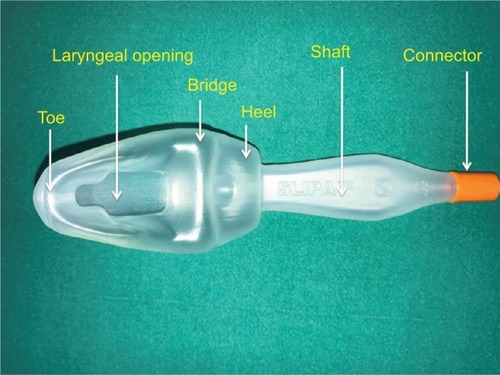 Figure 6 Streamlined Liner of the Pharynx Airway.