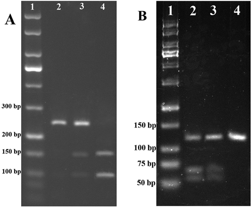 Figure 1. RFLP analysis of XRCC1 and LIG4. Polymorphisms were investigated by RFLP technique using MspI and HpyCH4 III (Thermo Scientific, USA) as restriction enzymes for ARCC1 and LIG4, respectively. Digested products have been checked by electrophoresis on 3.0% agarose gel and then visualized under UV light. (A) XRCC1 Arg399Gln (G to A). Lane 1 is 50 bp DNA ladder (Jena Bioscience, Germany); Lane 2 is GG genotype (242bp); Lane 3 is GA genotype (242, 148 and 94 bp); Lane 4 is AA genotype (148 and 94 bp); (B) LIG4 Thr9Ile (C to T). Lane 1 is 50 bp DNA ladder (Jena Bioscience); Lane 2 is CC genotype (65 and 56 bp); Lane 3 is CT genotype (121, 65 and 56 bp); Lane 4 is TT genotype (121 bp).