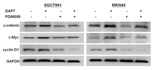 Figure 5. Effect of PD98059 on DAPT-induced change in related signaling protein levels. SGC7901 and MKN45 cells were treated with 10 μM DAPT and 10 μM PD98059 for 24 h. The levels of β-catenin, c-Myc, and cyclin D1 were analyzed by western blotting with their specific antibodies.