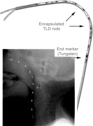 Figure 1. Photo of the tube containing ten encapsulated TLD rods. The tube extends several centimetres beyond the tungsten “end markers” only for the purpose of the patients' comfort. The total length of the tube is approximately 30 cm but depends on anatomy and diagnose. Inserted picture (lower left) shows an EPID image with TLD rods (white crosses) interspaced with lead markers. The black arrow marks the isocentre.