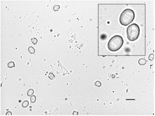 Figure 3 Globose spore shape seen following in vitro acid digestion and zinc sulfate flotation (phase 2).