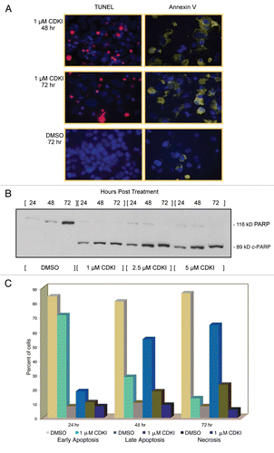 Figure 5 Inhibiting the function of CDKs in melanoma cells leads to melanoma cell apoptosis. (A) WM1158 MGP melanoma cells, treated with 1 µM of the CDK inhibitor (CDKI) for 48 or 72 hr, were analyzed by immunofluorescence-based TUNEL and likewise, Annexin V staining. WM1158 MGP melanoma cells that received only DMSO for 72 hr served as the control. Melanoma cells that had undergone apoptosis are pseudocolored red (TUNEL staining) or pseudocolored yellow (Annexin V staining). Fluorescent DAPI-counterstained nuclei are pseudocolored blue. (B) Immunoblot analysis of WM1158 MGP melanoma cells, treated with 1 µM, 2.5 µM, or 5 µM of the CDK inhibitor (CDKI) for 24, 48, or 72 hr, were probed with an antibody to c-PARP. WM1158 cells that received DMSO for 24, 48, and 72 hr served as the control. (C) After 24, 48, as well as 72 hr following treatment with 1 µM of the CDK inhibitor (CDKI, blue-colored bars), WM1158 MGP melanoma cells were labeled with Annexin V/Propidium Iodide and analyzed by flow cytometry. WM1158 cells that had received only DMSO (DMSO, grey-colored bars) served as the control. At each time point, the light-colored bars represent the percent of melanoma cells in the early stage of apoptosis, medium-colored bars the percent of melanoma cells in late-stage apoptosis and dark-colored bars the percent of necrotic melanoma cells.