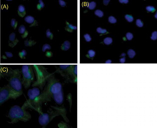 Figure 2. Detection of 2-week EPC surface molecular markers by immunofluorescence. (A) Cells stained positive with CD133, (B) cells stained positive with vWF, (C) cells stained positive with VEGFR-2; the cells showed reactivity to CD133, vWF, and VEGFR-2 that indicated typical markers of EPC.