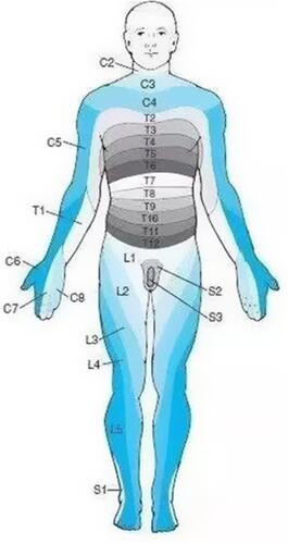Figure 1 The picture shows the distribution of the skin nodes in the innervated area, and the distribution of the nerve skin nodes involving C3-8 in herpes zoster patients is located in one limb.