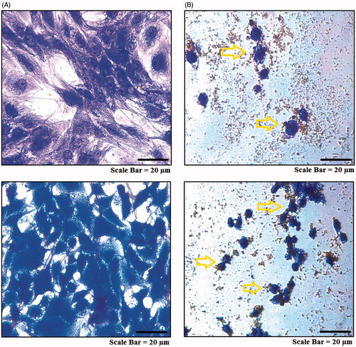 Figure 11. Microscopic images of in vitro targeting of cancer cells with MNPs. AMJ-13 cell line: (upper lane) and MCF-7 cell line: (lower lane). (A) Non-treated cells. (B) Cells incubated with MNPs at concentration of 62.5 μg mL−1 for 24 h.
